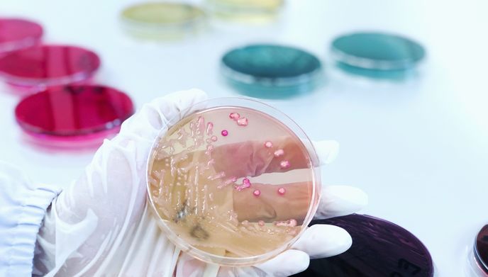 Mannitol salt agar (MSA Agar) in Petri dish used selective and differential growth medium in microbiology cultured Gram-positive bacteria (Staphylococcus and Micrococcaceae) Handle in scientist hands.